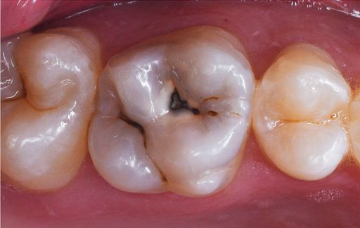 Smile Gallery - A2Z Dental - Before and After Photos